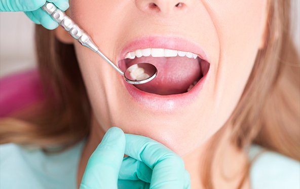 Dentist checking smile after metal free dental restorations