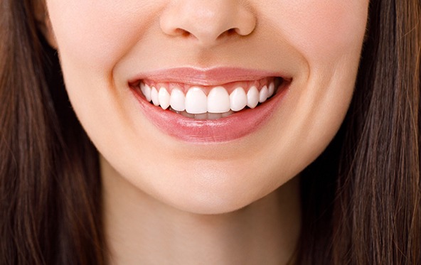 Nose-to-neck view of woman smiling with perfect teeth