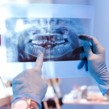 Dentist looking at X-ray in treatment room